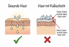 nie mehr trockene haut mit dem duschheld von vodaclean